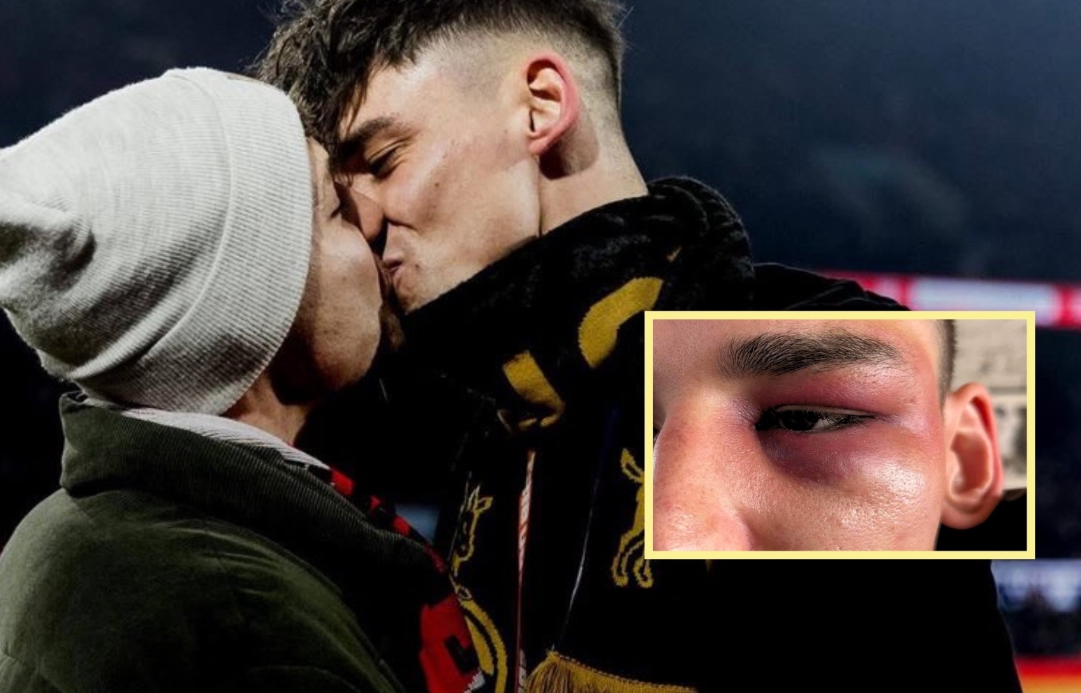 Referee Who Proposed Marriage in a Stadium Victim of Homophobic Assault