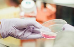 Dermatophilosis: Should We Worry About This Infection Observed in Gay Men?